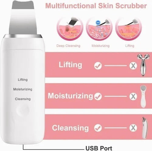 Limpiador Facial Exfoliador Ultrasonico Skin Scrubber Sonic