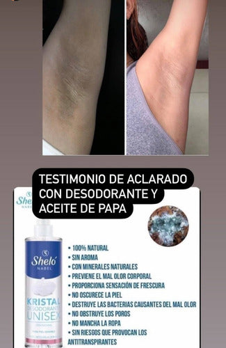 Kit Aclarador De Axilas Aceite De Papa, Desodorante Sheló Na