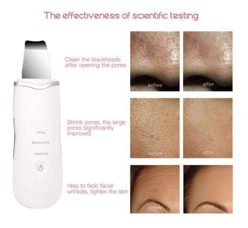 Skin Scrubber+vapor+radiofrecuencia Kit Facial Envio Gratis