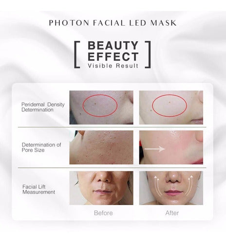 Máscara De Fotones C/luces Led Para Rejuvenecimiento Facial