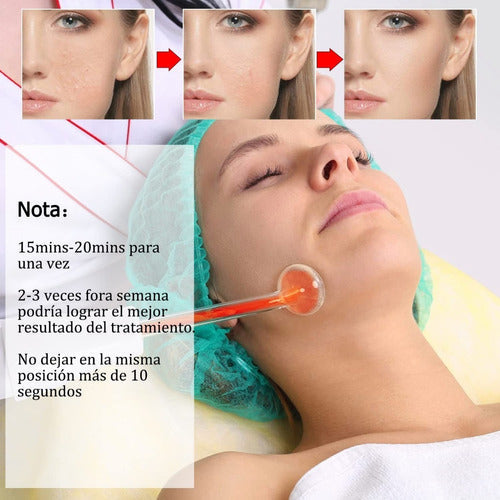 Máquina Terapia Piel, Facial Dispositivos De Alta Frecuencia