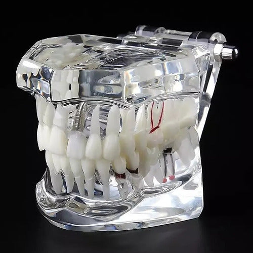 Modelo Dental Patologías-tx Tipodonto Didáctico Transparente