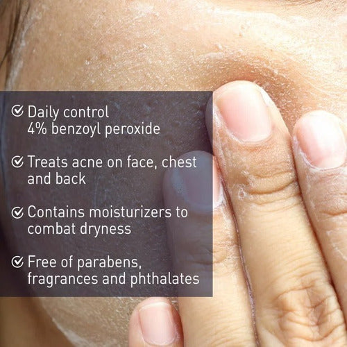 Panoxyl Acné Creamy Facial Wash 4% Peróxido De Benzoilo Usa