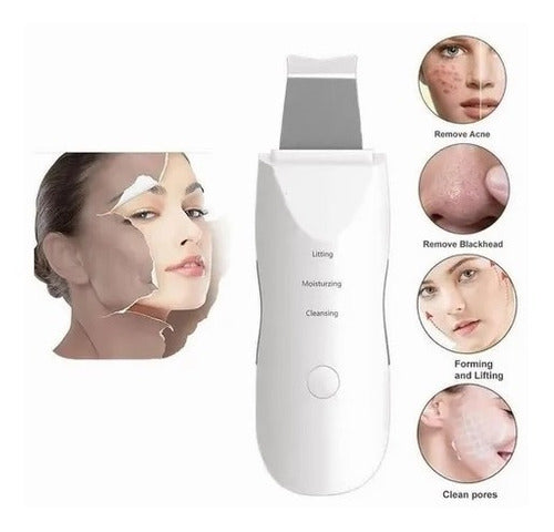 Limpiador Facial Exfoliador Ultrasonico Skin Scrubber Sonic